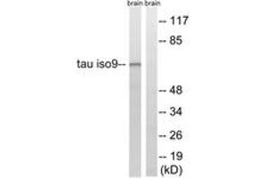 Western blot analysis of extracts from rat brain cells, using Tau (Ab-534/217) Antibody. (tau antibody  (AA 181-230))