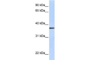 WB Suggested Anti-TTMB Antibody Titration:  0. (TMEM200B antibody  (N-Term))