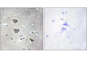 Immunohistochemistry analysis of paraffin-embedded human brain tissue, using 5-HT-2C Antibody. (HTR2C antibody  (AA 161-210))