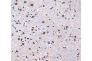 Used in DAB staining on fromalin fixed paraffin- embedded spinal cord tissue (Renin antibody  (AA 275-389))