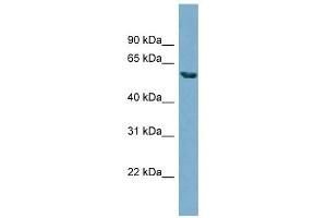 HHAT antibody used at 1 ug/ml to detect target protein. (HHAT antibody  (N-Term))