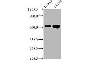 Western Blot Positive WB detected in: Rat liver tissue, Mouse liver tissue All lanes: PRSS16 antibody at 3. (PRSS16 antibody  (AA 352-489))