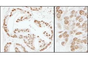 Immunohistochemistry (IHC) image for anti-Activated RNA Polymerase II Transcriptional Coactivator p15 (SUB1) (AA 77-127) antibody (ABIN7454530)