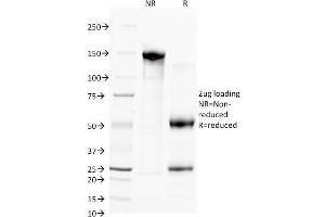SDS-PAGE Analysis Purified CD38 Mouse Monoclonal Antibody (FS02). (CD38 antibody)