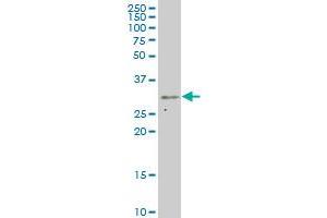 CRSP9 monoclonal antibody (M02), clone 2D7 Western Blot analysis of CRSP9 expression in Hela S3 NE . (MED7 antibody  (AA 1-233))