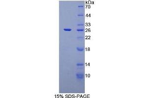 SDS-PAGE (SDS) image for CD72 Molecule (CD72) (AA 169-359) protein (His tag) (ABIN1878613)