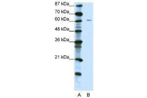 WB Suggested Anti-ZNF286  Antibody Titration: 1.