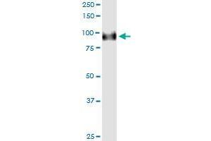 Immunoprecipitation of FBXO42 transfected lysate using rabbit polyclonal anti-FBXO42 and Protein A Magnetic Bead (FBXO42 (Human) IP-WB Antibody Pair)