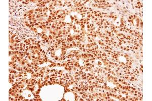 IHC-P Image Immunohistochemical analysis of paraffin-embedded NCI-N87 xenograft, using C9orf78, antibody at 1:500 dilution. (C9orf78 antibody)