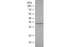 Western Blotting (WB) image for Adenosine Diphosphate (ADP) (AA 19-244) protein (His tag) (ABIN7121709) (ADP Protein (AA 19-244) (His tag))