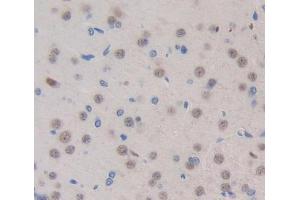 Used in DAB staining on fromalin fixed paraffin- embedded brain tissue (Exonuclease 1 antibody  (AA 1-250))