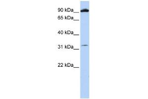 WB Suggested Anti-GRM6 Antibody Titration: 0. (Metabotropic Glutamate Receptor 6 antibody  (N-Term))