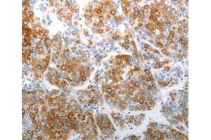 Immunohistochemical analysis of paraffin-embedded Human tonsil cancer tissue using at dilution 1/40. (CHD5 antibody  (C-Term))