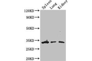 Western Blot Positive WB detected in: Mouse spleen tissue, Mouse lung tissue, Mouse kidney tissue All lanes: ALKBH4 antibody at 3 μg/mL Secondary Goat polyclonal to rabbit IgG at 1/50000 dilution Predicted band size: 34, 5 kDa Observed band size: 34 kDa (ALKBH4 antibody  (AA 1-115))