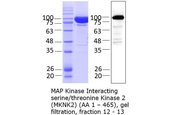 MKNK2 Protein (AA 1-465) (Strep Tag)
