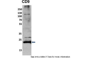 Sample Type: mouse fibroblast lusate (10ug)Primary Dilution: 1:2000 (1% BSA)Secondary Dilution: 1:2000 (5% milk)Image Submitted By: Anonymous researcher . (CD9 antibody  (N-Term))