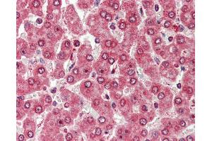 Anti-CXADR antibody IHC of human liver. (Coxsackie Adenovirus Receptor antibody  (Internal Region))