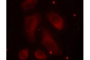 Immunofluorescence staining of methanol-fixed Hela cells using LIMK1(Phospho-Thr508) Antibody. (LIM Domain Kinase 1 antibody  (pThr508))