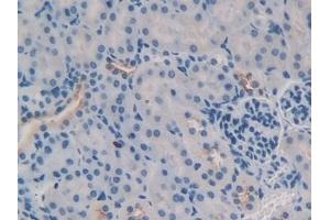 Detection of TNFSF9 in Mouse Kidney Tissue using Polyclonal Antibody to Tumor Necrosis Factor Ligand Superfamily, Member 9 (TNFSF9) (TNFSF9 antibody  (AA 105-309))
