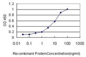 Detection limit for recombinant GST tagged ULK4 is approximately 0. (ULK4 antibody  (AA 1-580))