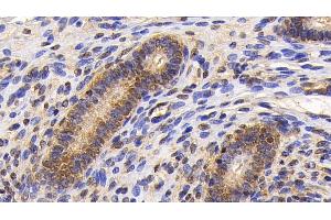 Detection of Surv in Human Uterus Tissue using Monoclonal Antibody to Survivin (Surv) (Survivin antibody  (AA 1-142))