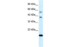 WB Suggested Anti-CGI-143 Antibody Titration:  0.