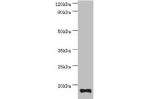 Western blot All lanes: TNNC2 antibody at 10 μg/mL + Mouse skeletal muscle tissue Secondary Goat polyclonal to rabbit IgG at 1/10000 dilution Predicted band size: 18 kDa Observed band size: 18 kDa (TNNC2 antibody  (AA 1-160))