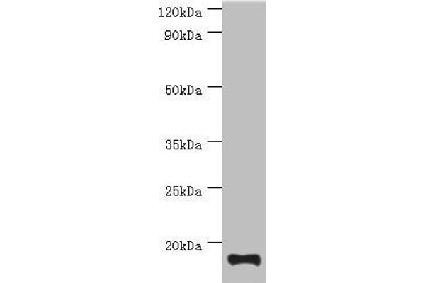 TNNC2 抗体  (AA 1-160)