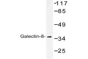 Western blot (WB) analysis of Galectin-8 antibody in extracts from 3T3 cells.