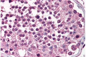 Human Testis (formalin-fixed, paraffin-embedded) stained with MADD antibody ABIN214509 at 2. (MADD antibody  (C-Term))