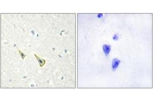 Immunohistochemistry analysis of paraffin-embedded human brain, using Calsenilin/KCNIP3 (Phospho-Ser63) Antibody. (DREAM antibody  (pSer63))
