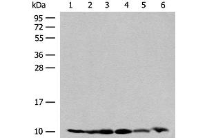 Western blot analysis of 293T and PC3 cell Mouse spleen tissue 231 cell Human breast cancer tissue Mouse kidney tissue lysates using RPS28 Polyclonal Antibody at dilution of 1:200 (RPS28 antibody)