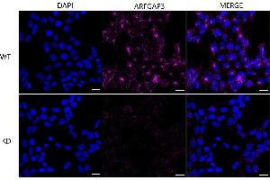 Immunocytochemical staining of HeLa cells using ARFGAP3 antibody (ABIN7797533), 1:1,000), Top panel: wild-type (WT), Bottom panal: ARFGAP3 shRNA knockdown (KD). (ARFGAP3 antibody)