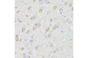 Immunohistochemistry of paraffin-embedded mouse brain using TRAP1 Antibody (ABIN1875197) at dilution of 1:100 (40x lens). (TRAP1 antibody)