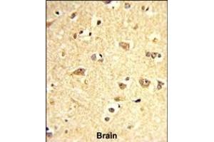Formalin-fixed and paraffin-embedded human brain reacted with SOX4 Antibody (Center), which was peroxidase-conjugated to the secondary antibody, followed by DAB staining.