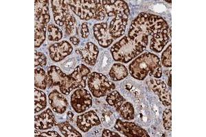 Immunohistochemical staining of human kidney with SLC10A7 polyclonal antibody  shows strong cytoplasmic positivity in cells in tubules at 1:50-1:200 dilution. (SLC10A7 antibody)