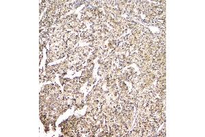 IHC analysis of EVA1A using anti-EVA1A antibody (ABIN6719564). (TMEM166 antibody)