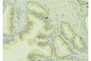 ABIN6279822 at 1/100 staining Mouse colon tissue by IHC-P. (CCL13 antibody)