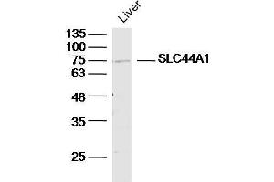 Mouse liver lysates probed with SLC44A1/CD92 Polyclonal Antibody, unconjugated  at 1:300 overnight at 4°C followed by a conjugated secondary antibody for 60 minutes at 37°C. (SLC44A1 antibody  (AA 81-180))
