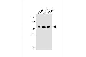 All lanes : Anti-OTC Antibody (Center) at 1:2000 dilution Lane 1: Human liver lysate Lane 2: Mouse liver lysate Lane 3: Rat liver lysate Lysates/proteins at 20 μg per lane. (OTC antibody  (AA 71-98))