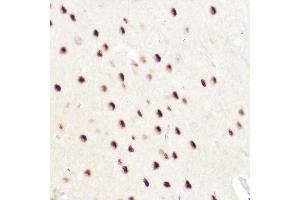 Immunohistochemistry of paraffin-embedded rat brain using CTIP2/BCL11B Rabbit pAb (ABIN7265808) at dilution of 1:50 (40x lens). (BCL11B antibody)