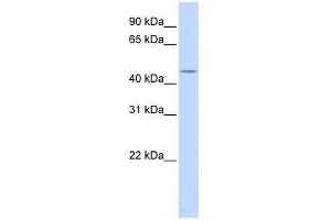 Western Blot showing HSFY1 antibody used at a concentration of 1-2 ug/ml to detect its target protein. (HSFY1 antibody  (Middle Region))