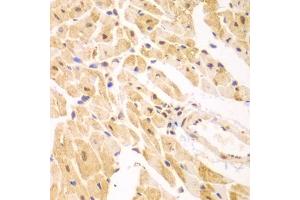 Immunohistochemistry of paraffin-embedded mouse heart using PSMD2 antibody (ABIN1874389) at dilution of 1:100 (40x lens). (PSMD2 antibody)