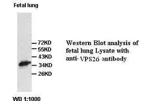 Image no. 1 for anti-Vacuolar Protein Sorting-Associated Protein 26A (VPS26A) antibody (ABIN791212) (VPS26A antibody)