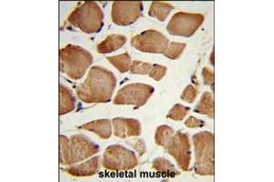 Formalin-fixed and paraffin-embedded human skeletal muscle reacted with NRP1 Antibody , which was peroxidase-conjugated to the secondary antibody, followed by DAB staining. (Neuropilin 1 antibody  (C-Term))