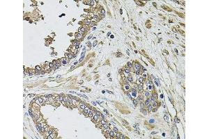 Immunohistochemistry of paraffin-embedded Human prostate using KCNK9 Polyclonal Antibody at dilution of 1:100 (40x lens). (KCNK9 antibody)