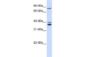 WB Suggested Anti-C18orf10 Antibody Titration: 0. (TPGS2 antibody  (Middle Region))