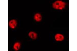 ABIN6266737 staining Hela by IF/ICC. (Histone H1 antibody  (Internal Region))