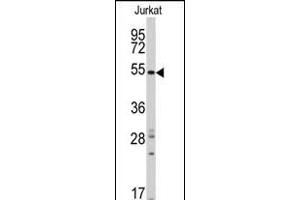 Western blot analysis of anti-RAI15 Antibody (C-term) ( (ABIN390172 and ABIN2840666) in Jurkat cell line lysates (35 μg/lane). (SMYD5 antibody  (C-Term))