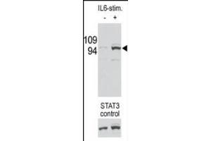 Image no. 1 for anti-Signal Transducer and Activator of Transcription 3 (Acute-Phase Response Factor) (STAT3) (pSer727) antibody (ABIN357083) (STAT3 antibody  (pSer727))